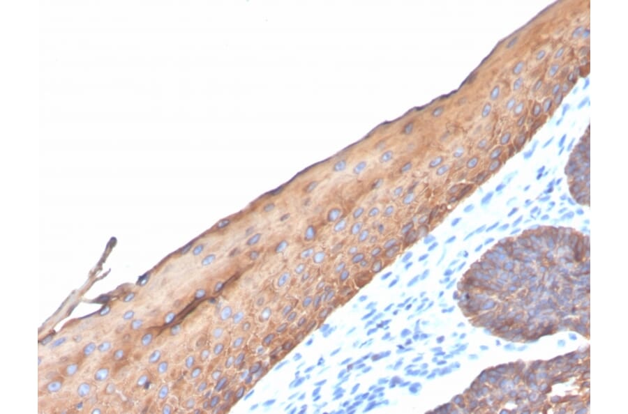 Immunohistochemistry - Anti-Keratin 77 Antibody [KRTL/4440R] - BSA and Azide free (A254199) - Antibodies.com