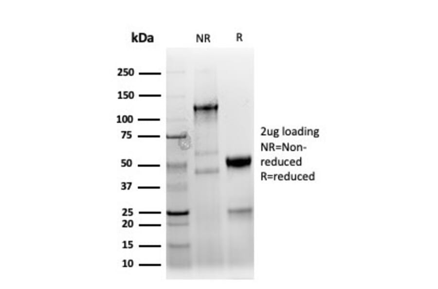 SDS-PAGE - Anti-Keratin 77 Antibody [KRTL/4440R] - BSA and Azide free (A254199) - Antibodies.com
