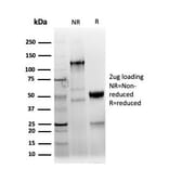 SDS-PAGE - Anti-Keratin 77 Antibody [KRTL/4440R] - BSA and Azide free (A254199) - Antibodies.com