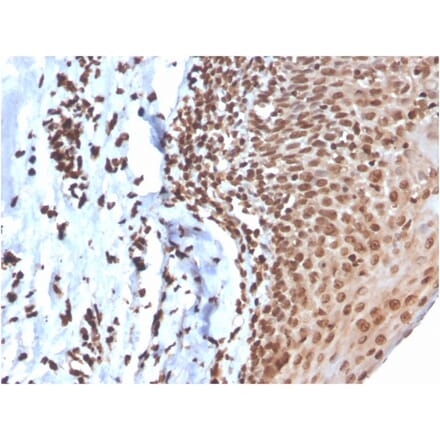 Immunohistochemistry - Anti-ds DNA Antibody [DSD/4054R] - BSA and Azide free (A254201) - Antibodies.com