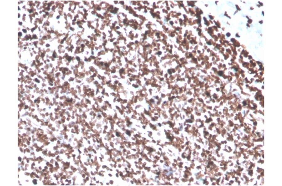 Immunohistochemistry - Anti-ds DNA Antibody [DSD/4054R] - BSA and Azide free (A254200) - Antibodies.com