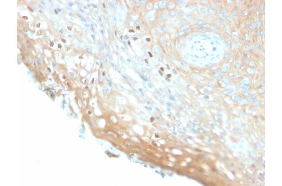 Immunohistochemistry - Anti-HPV16 L1 Antibody [HPV16/2058R] - BSA and Azide free (A254203) - Antibodies.com