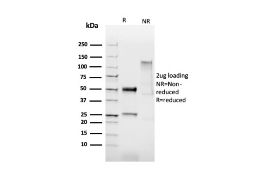 SDS-PAGE - Anti-HPV16 L1 Antibody [HPV16/2058R] - BSA and Azide free (A254204) - Antibodies.com