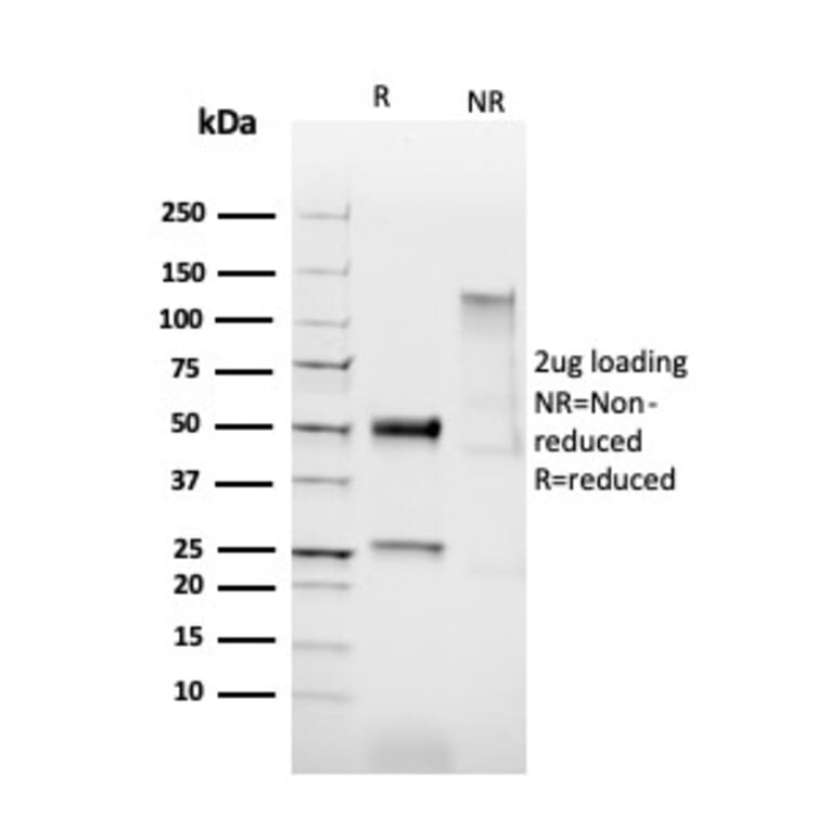 SDS-PAGE - Anti-HPV16 L1 Antibody [HPV16/2058R] - BSA and Azide free (A254204) - Antibodies.com