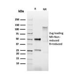 SDS-PAGE - Anti-HPV16 L1 Antibody [HPV16/2058R] - BSA and Azide free (A254204) - Antibodies.com