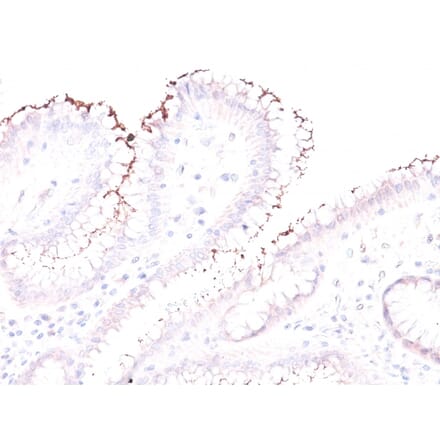 Immunohistochemistry - Anti-Helicobacter Pylori Antibody - BSA and Azide free (A254205) - Antibodies.com