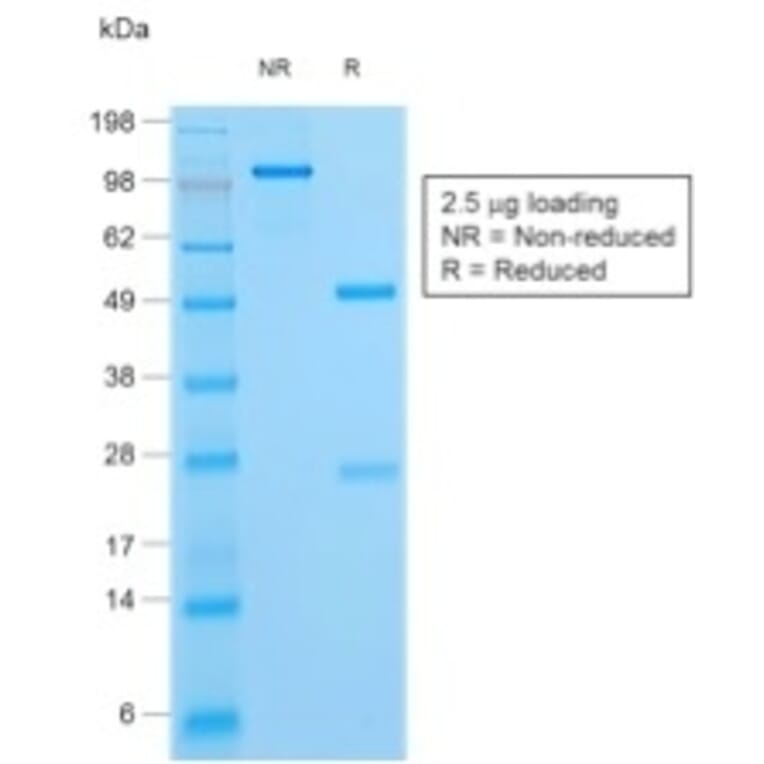 SDS-PAGE - Anti-HSV1 Antibody - BSA and Azide free (A254207) - Antibodies.com