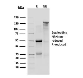 SDS-PAGE - Anti-IL10RA Antibody [1B1.3a] - BSA and Azide free (A254210) - Antibodies.com