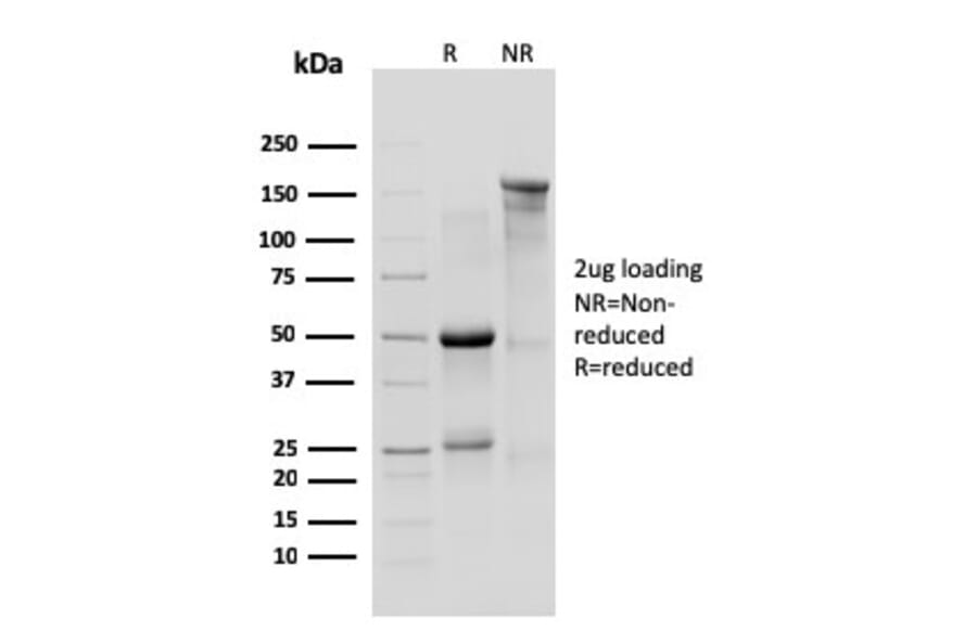 SDS-PAGE - Anti-IL10RA Antibody [1B1.3a] - BSA and Azide free (A254210) - Antibodies.com
