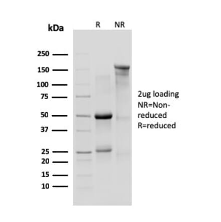 SDS-PAGE - Anti-IL10RA Antibody [1B1.3a] - BSA and Azide free (A254210) - Antibodies.com