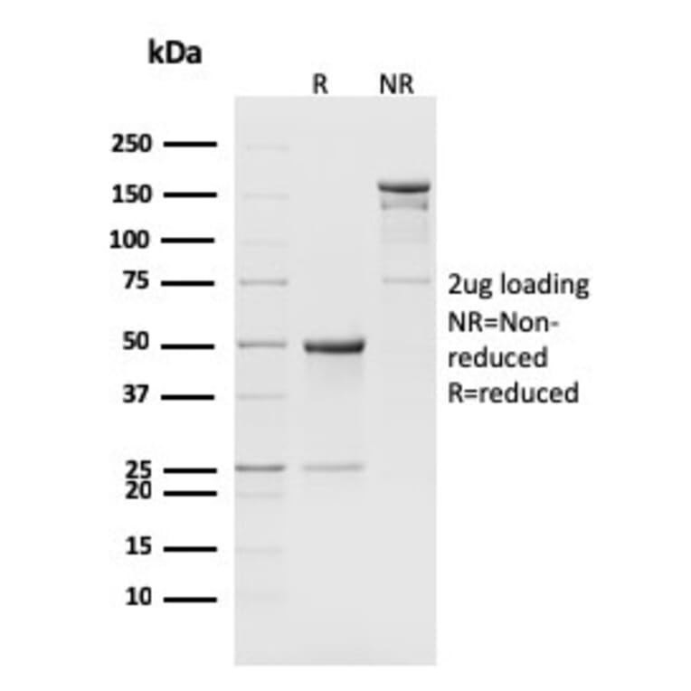 SDS-PAGE - Anti-CD8B Antibody [H35-17.2] - BSA and Azide free (A254212) - Antibodies.com