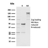 SDS-PAGE - Anti-CD8B Antibody [H35-17.2] - BSA and Azide free (A254212) - Antibodies.com