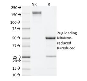 SDS-PAGE - Anti-IL-4 Antibody [11B11] - BSA and Azide free (A254214) - Antibodies.com