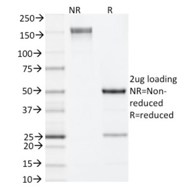 SDS-PAGE - Anti-IL-4 Antibody [11B11] - BSA and Azide free (A254214) - Antibodies.com