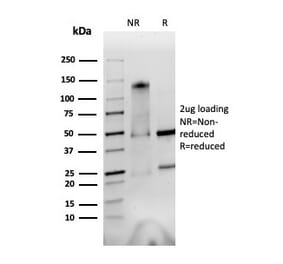 SDS-PAGE - Anti-Integrin alpha V + beta 6 Antibody [AvB6 53a.2] - BSA and Azide free (A254216) - Antibodies.com