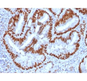 Immunohistochemistry - Anti-Estrogen Receptor alpha Antibody [1D5] (A254219) - Antibodies.com