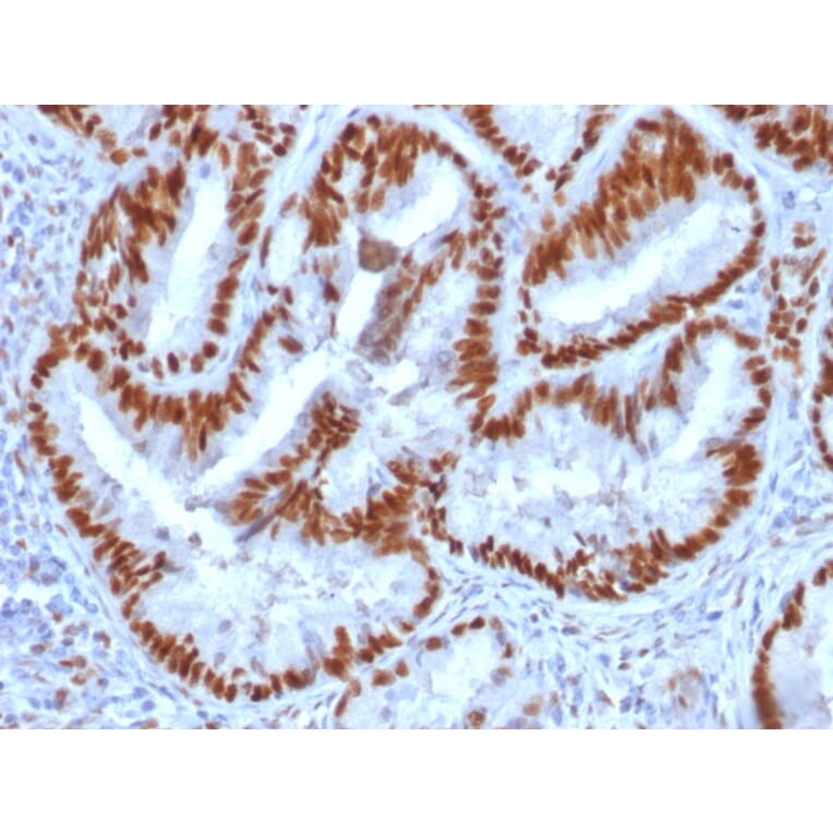 Immunohistochemistry - Anti-Estrogen Receptor alpha Antibody [1D5] (A254219) - Antibodies.com