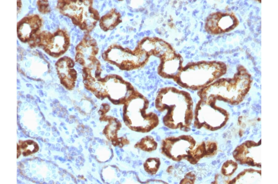 Immunohistochemistry - Anti-AMACR Antibody [13H4] (A254279) - Antibodies.com