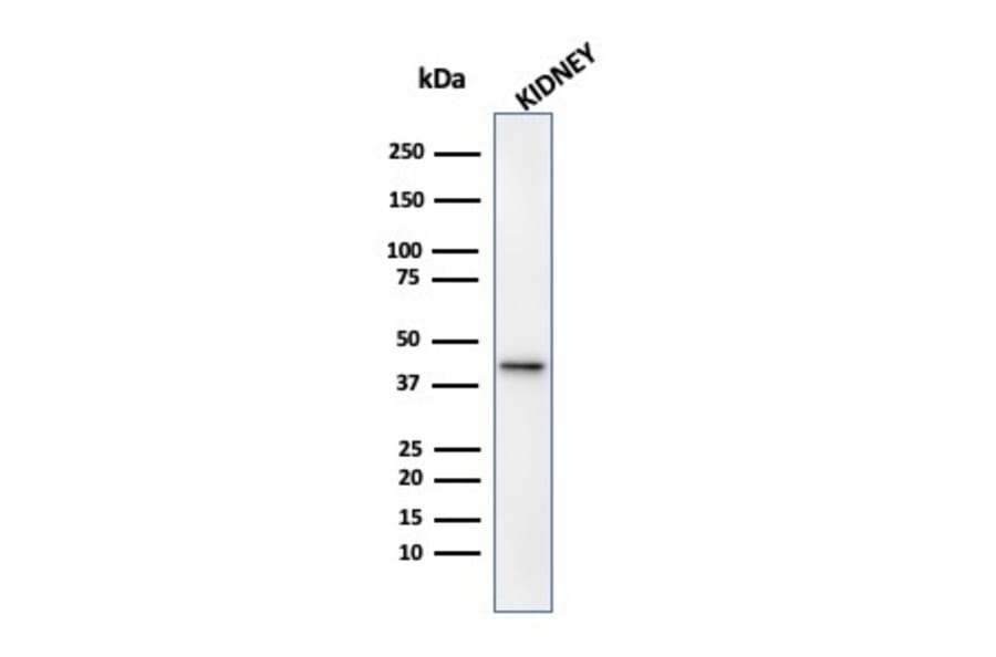 Western Blot - Anti-AMACR Antibody [13H4] (A254279) - Antibodies.com