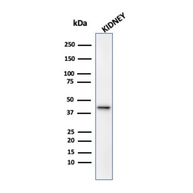 Western Blot - Anti-AMACR Antibody [13H4] (A254279) - Antibodies.com