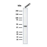 Western Blot - Anti-AMACR Antibody [13H4] (A254279) - Antibodies.com
