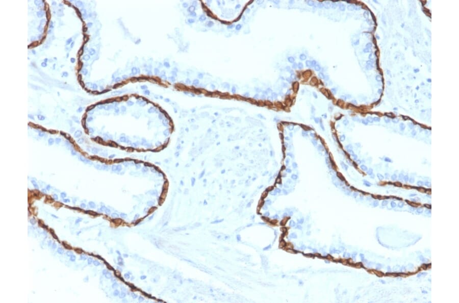 Immunohistochemistry - Anti-Cytokeratin 5 Antibody [KRT5/2080] (A254280) - Antibodies.com
