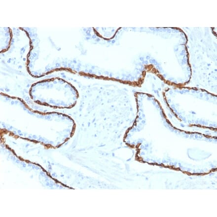Immunohistochemistry - Anti-Cytokeratin 5 Antibody [KRT5/2080] (A254280) - Antibodies.com