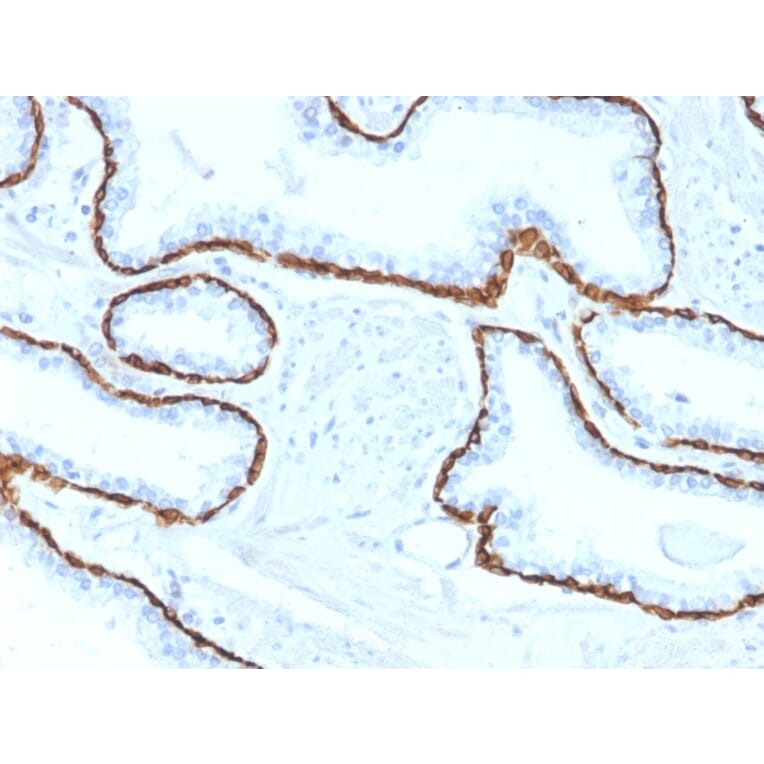 Immunohistochemistry - Anti-Cytokeratin 5 Antibody [KRT5/2080] (A254280) - Antibodies.com