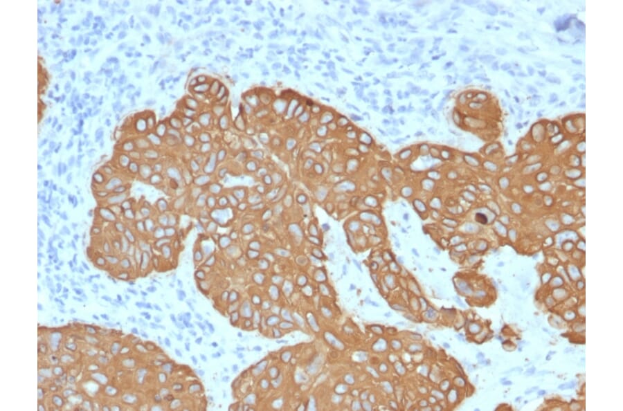 Immunohistochemistry - Anti-Cytokeratin 5 Antibody [KRT5/2080] (A254279) - Antibodies.com