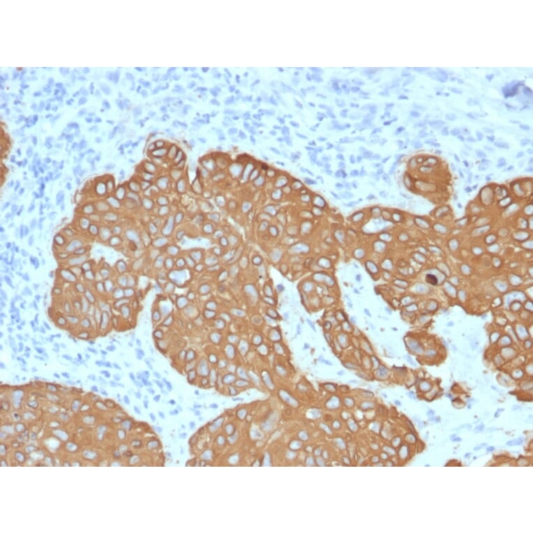Immunohistochemistry - Anti-Cytokeratin 5 Antibody [KRT5/2080] (A254279) - Antibodies.com