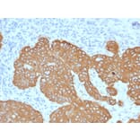 Immunohistochemistry - Anti-Cytokeratin 5 Antibody [KRT5/2080] (A254279) - Antibodies.com