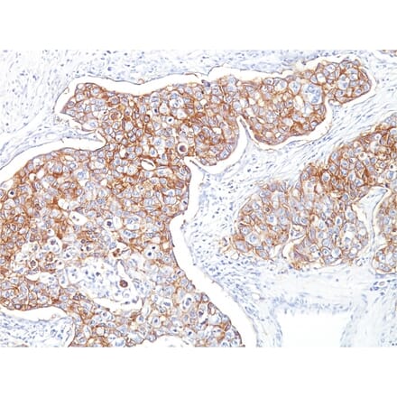 Immunohistochemistry - Anti-EpCAM Antibody [Ber-EP4] (A254281) - Antibodies.com