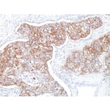 Immunohistochemistry - Anti-EpCAM Antibody [Ber-EP4] (A254281) - Antibodies.com