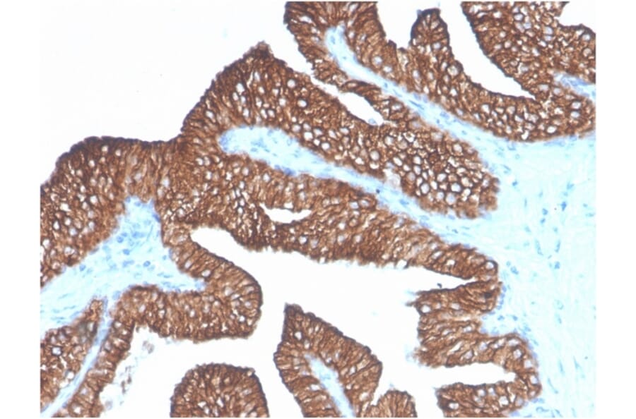 Immunohistochemistry - Anti-EpCAM Antibody [Ber-EP4] (A254281) - Antibodies.com