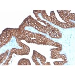 Immunohistochemistry - Anti-EpCAM Antibody [Ber-EP4] (A254281) - Antibodies.com