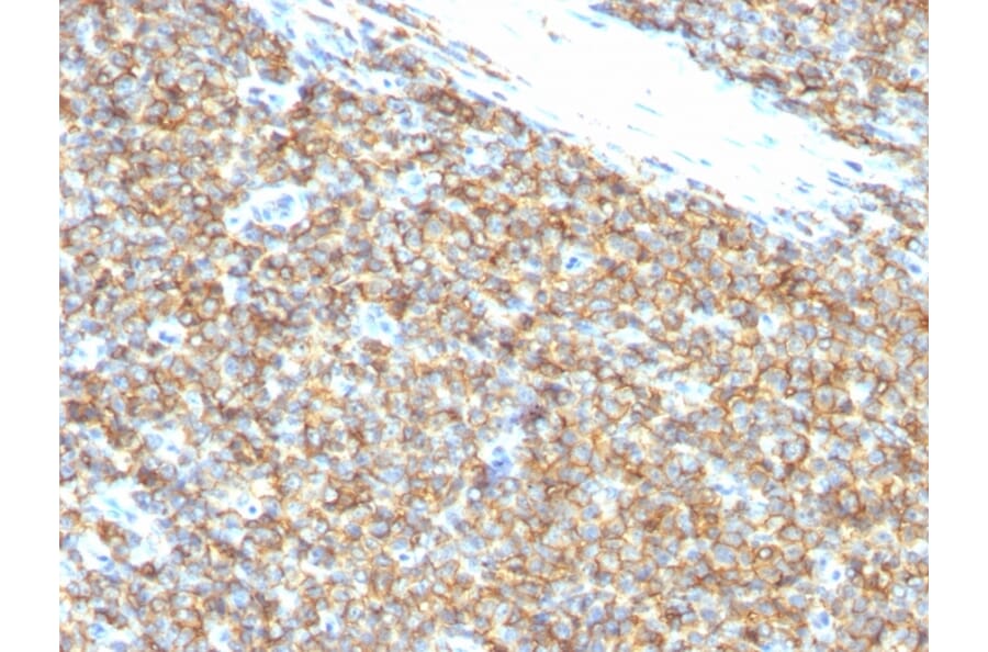 Immunohistochemistry - Anti-CD99 Antibody [12E7] (A254281) - Antibodies.com