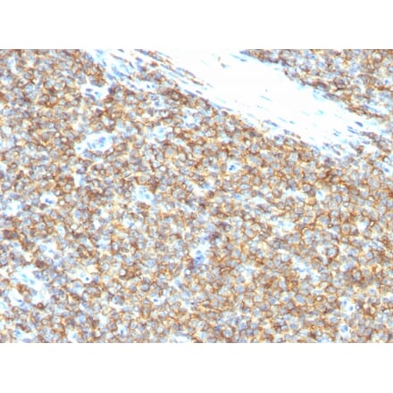 Immunohistochemistry - Anti-CD99 Antibody [12E7] (A254281) - Antibodies.com