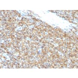 Immunohistochemistry - Anti-CD99 Antibody [12E7] (A254281) - Antibodies.com