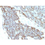 Immunohistochemistry - Anti-CD99 Antibody [12E7 + MIC2/877] (A254282) - Antibodies.com