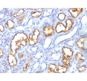 Immunohistochemistry - Anti-CD10 Antibody [56C6] (A254283) - Antibodies.com