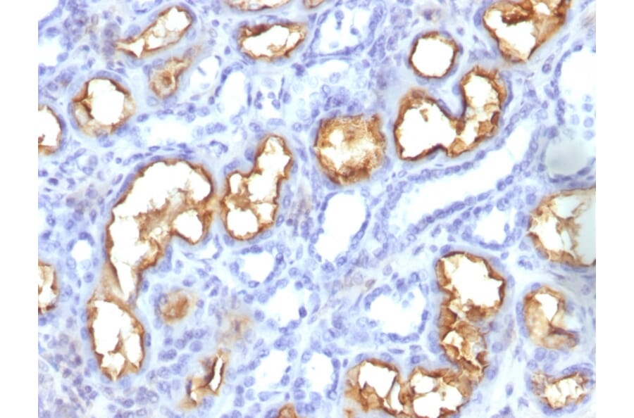 Immunohistochemistry - Anti-CD10 Antibody [56C6] (A254283) - Antibodies.com