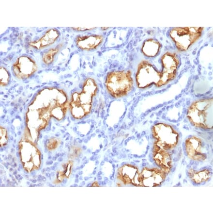 Immunohistochemistry - Anti-CD10 Antibody [56C6] (A254283) - Antibodies.com