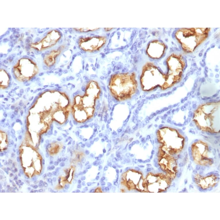 Immunohistochemistry - Anti-CD10 Antibody [56C6] (A254283) - Antibodies.com