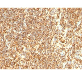 Immunohistochemistry - Anti-CD20 Antibody [SPM494] (A254286) - Antibodies.com
