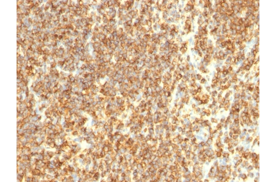 Immunohistochemistry - Anti-CD20 Antibody [SPM494] (A254286) - Antibodies.com
