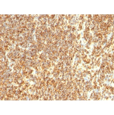 Immunohistochemistry - Anti-CD20 Antibody [SPM494] (A254286) - Antibodies.com