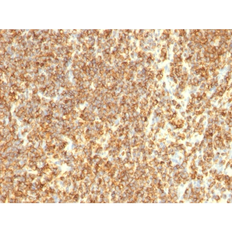Immunohistochemistry - Anti-CD20 Antibody [SPM494] (A254286) - Antibodies.com