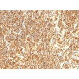 Immunohistochemistry - Anti-CD20 Antibody [SPM494] (A254286) - Antibodies.com