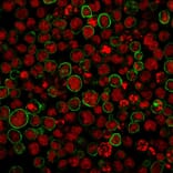 Immunofluorescence - Anti-CD20 Antibody [SPM494] (A254286) - Antibodies.com
