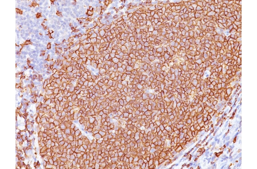 Immunohistochemistry - Anti-CD20 Antibody [L26 + IGEL/773] (A254287) - Antibodies.com
